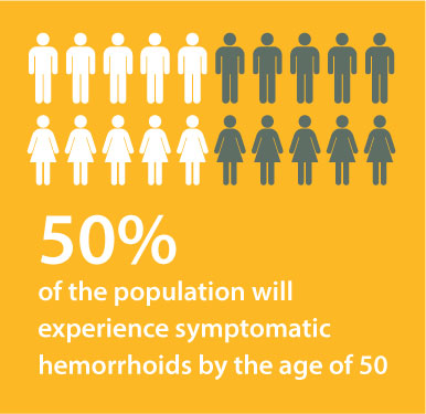 illustration explain 50% of the population will suffer from Hemorrhoids by the age of 50
