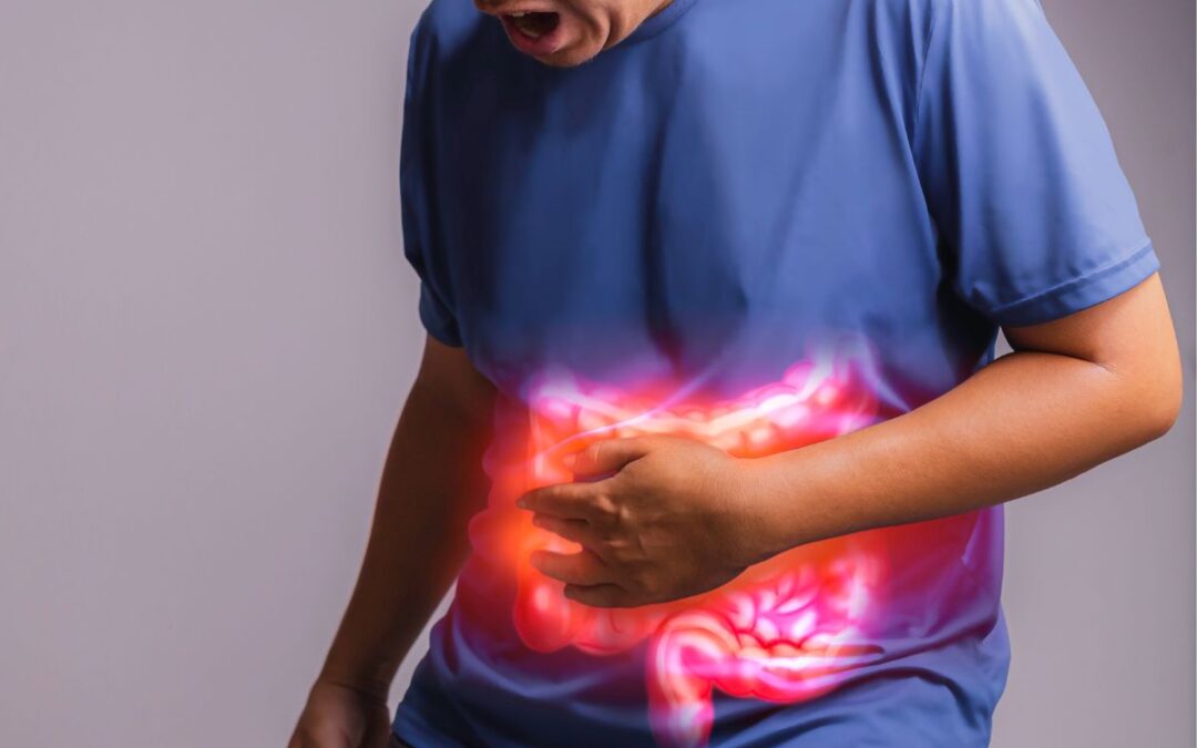 Unraveling Crohns Disease: A Comprehensive Overview