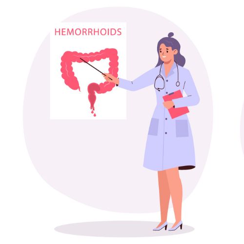 Illustration of lady doctor giving Hemorrhoids instructions.